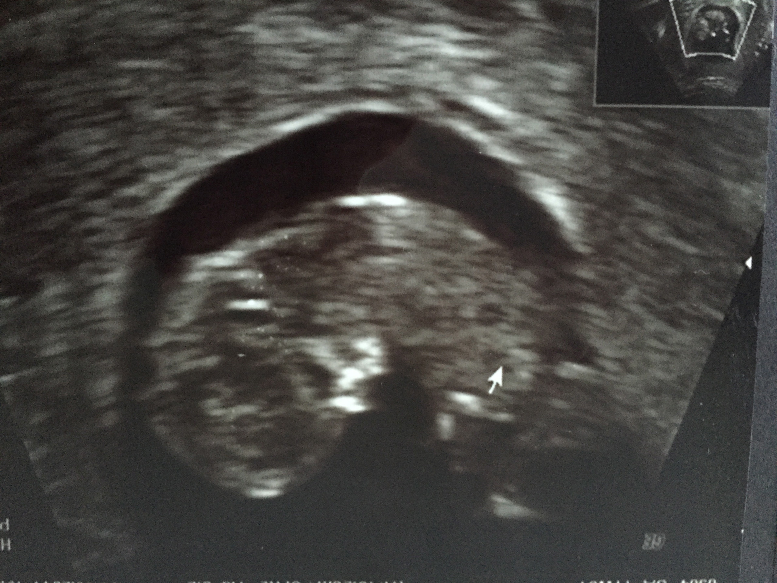 «Wann fängt etwas an?»